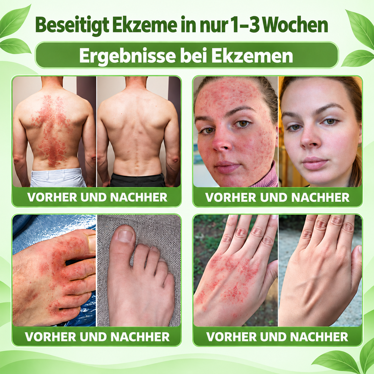 𝐌𝐎𝐏𝐑𝐎® 👩‍⚕️👩‍⚕️ 𝐈𝐋-𝟐𝟑𝐑-𝐀𝐧𝐭𝐚𝐠𝐨𝐧𝐢𝐬𝐭-𝐏𝐞𝐩𝐭𝐢𝐝 + 𝐈𝐧𝐝𝐢𝐫𝐮𝐛𝐢𝐧 𝟏𝟎-𝐈𝐍-𝟏 𝐍𝐚𝐧𝐨-𝐌𝐢𝐤𝐫𝐨𝐧𝐚𝐝𝐞𝐥-𝐏𝐟𝐥𝐚𝐬𝐭𝐞𝐫 (𝐇𝐢𝐥𝐟𝐭 𝐛𝐞𝐢 𝐑ö𝐭𝐮𝐧𝐠𝐞𝐧, 𝐒𝐜𝐡𝐮𝐩𝐩𝐮𝐧𝐠, 𝐓𝐫𝐨𝐜𝐤𝐞𝐧𝐡𝐞𝐢𝐭 & 𝐉𝐮𝐜𝐤𝐫𝐞𝐢𝐳 𝐮𝐧𝐝 𝐮𝐧𝐭𝐞𝐫𝐬𝐭ü𝐭𝐳𝐭 𝐇𝐚𝐮𝐭𝐞𝐫𝐧𝐞𝐮𝐞𝐫𝐮𝐧𝐠 & 𝐇𝐚𝐮𝐭𝐛𝐚𝐫𝐫𝐢𝐞𝐫𝐞.)