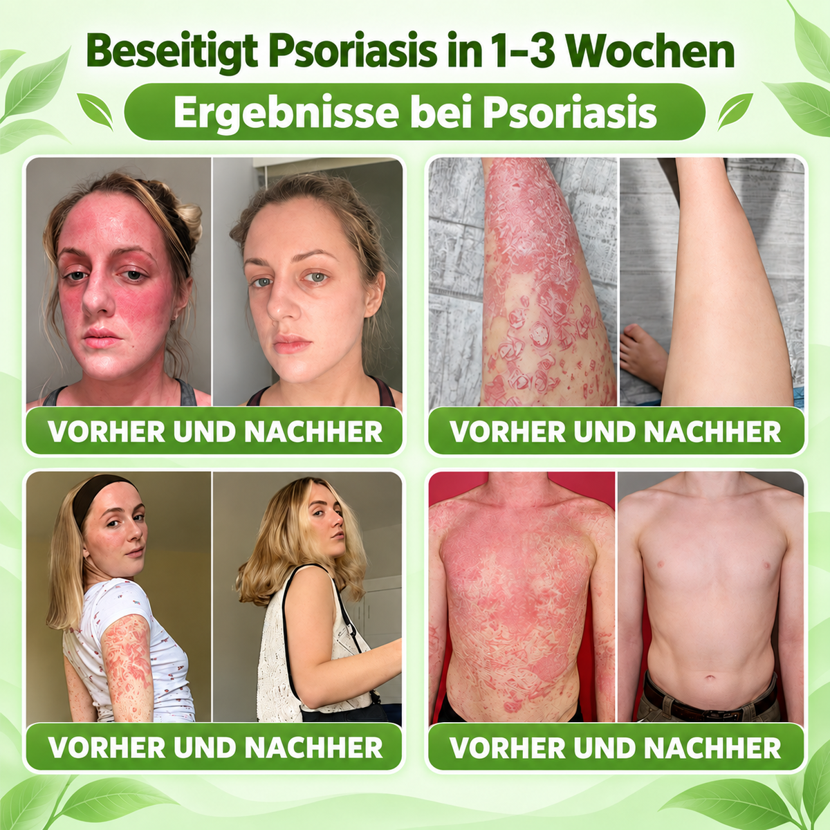 𝐌𝐎𝐏𝐑𝐎® 👩‍⚕️👩‍⚕️ 𝐈𝐋-𝟐𝟑𝐑-𝐀𝐧𝐭𝐚𝐠𝐨𝐧𝐢𝐬𝐭-𝐏𝐞𝐩𝐭𝐢𝐝 + 𝐈𝐧𝐝𝐢𝐫𝐮𝐛𝐢𝐧 𝟏𝟎-𝐈𝐍-𝟏 𝐍𝐚𝐧𝐨-𝐌𝐢𝐤𝐫𝐨𝐧𝐚𝐝𝐞𝐥-𝐏𝐟𝐥𝐚𝐬𝐭𝐞𝐫 (𝐇𝐢𝐥𝐟𝐭 𝐛𝐞𝐢 𝐑ö𝐭𝐮𝐧𝐠𝐞𝐧, 𝐒𝐜𝐡𝐮𝐩𝐩𝐮𝐧𝐠, 𝐓𝐫𝐨𝐜𝐤𝐞𝐧𝐡𝐞𝐢𝐭 & 𝐉𝐮𝐜𝐤𝐫𝐞𝐢𝐳 𝐮𝐧𝐝 𝐮𝐧𝐭𝐞𝐫𝐬𝐭ü𝐭𝐳𝐭 𝐇𝐚𝐮𝐭𝐞𝐫𝐧𝐞𝐮𝐞𝐫𝐮𝐧𝐠 & 𝐇𝐚𝐮𝐭𝐛𝐚𝐫𝐫𝐢𝐞𝐫𝐞.)